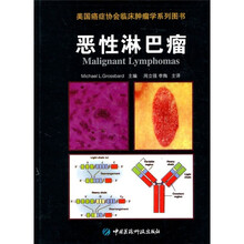 恶性淋巴瘤