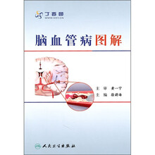 脑血管病图解