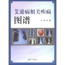 艾滋病相关疾病图谱