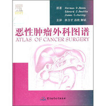 恶性肿瘤外科图谱