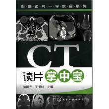 影像读片一学就会系列:CT读片掌中宝