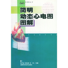 简明动态心电图图解