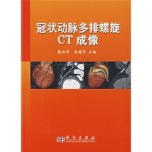 冠状动脉多排螺旋CT成像