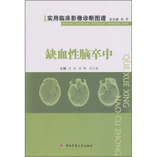 实用临床影像诊断图谱:缺血性脑卒中