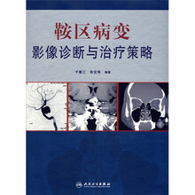 鞍区病变影像诊断与治疗策略
