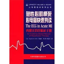 急性心肌梗死心电图快速判读:再灌注治疗循证手册