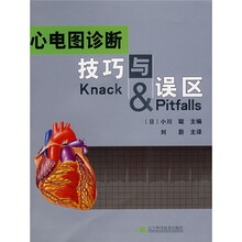心电图诊断技巧与误区