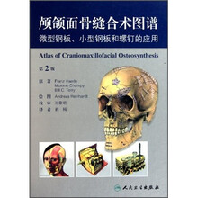颅颌面骨缝合术图谱：微型钢板小型钢板和螺钉的应用（第2版）
