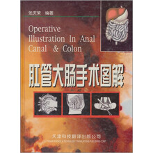 肛管大肠手术图解