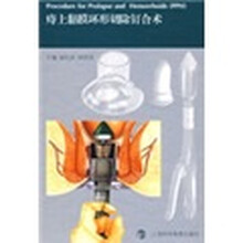 痔上黏膜环形切除钉合术