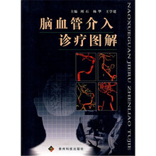 脑血管介入诊疗图解