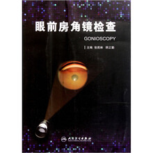 眼前房角镜检查