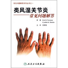 类风湿关节炎常见问题解答(翻译版)