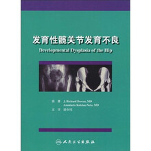 发育性髋关节发育不良