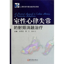 室性心律失常的射频消融治疗