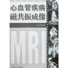 心血管病磁共振成像