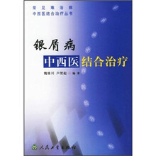 银屑病:中西医结合治疗