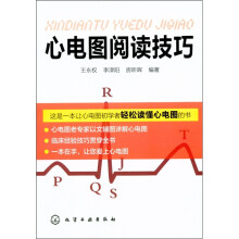 心电图阅读技巧