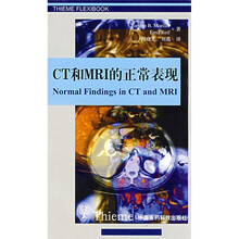 CT和MRI的正常表现