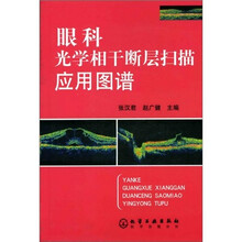 眼科光学相干断层扫描应用图谱