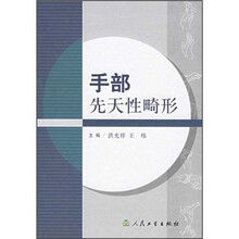 手部先天性畸形