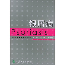 银屑病