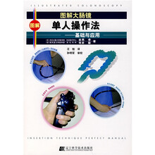 图解大肠镜单人操作法:基础与应用