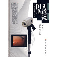 阴道镜图谱（第2版）