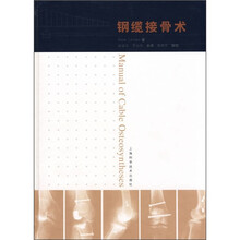 钢缆接骨术