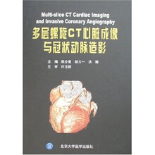多层螺旋CT心脏成像与冠状动脉造影