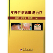 皮肤性病诊断与治疗