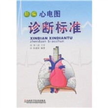 新编心电图诊断标准