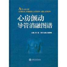心房颤动导管消融图谱