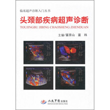 头颈部疾病超声诊断.临床超声诊断入门丛书