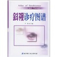 斜视诊疗图谱