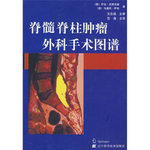 脊髓脊柱肿瘤外科手术图谱