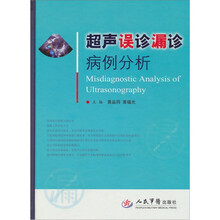 超声误诊漏诊病例分析