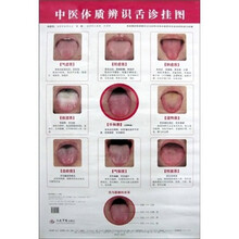 中医体质辨识舌诊挂图
