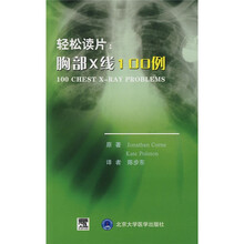 轻松读片：胸部X线100例