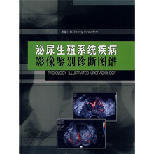 泌尿生殖系统疾病影像鉴别诊断图谱