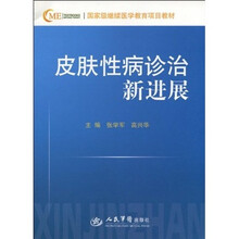 皮肤性病诊治新进展