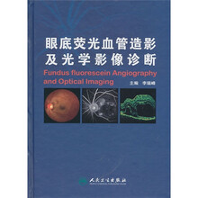 眼底荧光血管造影及光学影像诊断