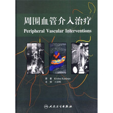 周围血管介入治疗