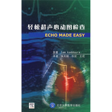 轻松超声心动图检查