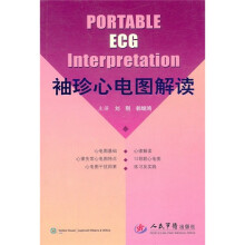 袖珍心电图解读