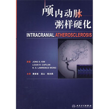 颅内动脉粥样硬化