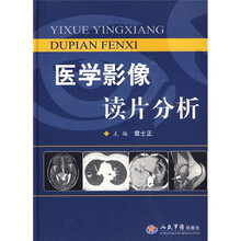 医学影像读片分析