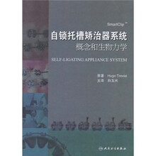 自锁托槽矫治器系统概念和生物力学