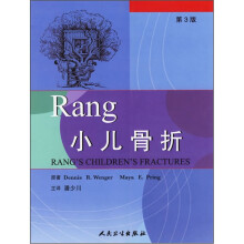 Ran小儿骨折