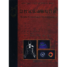 急性冠状动脉综合征